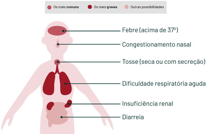 Sintomas do Coronavírus